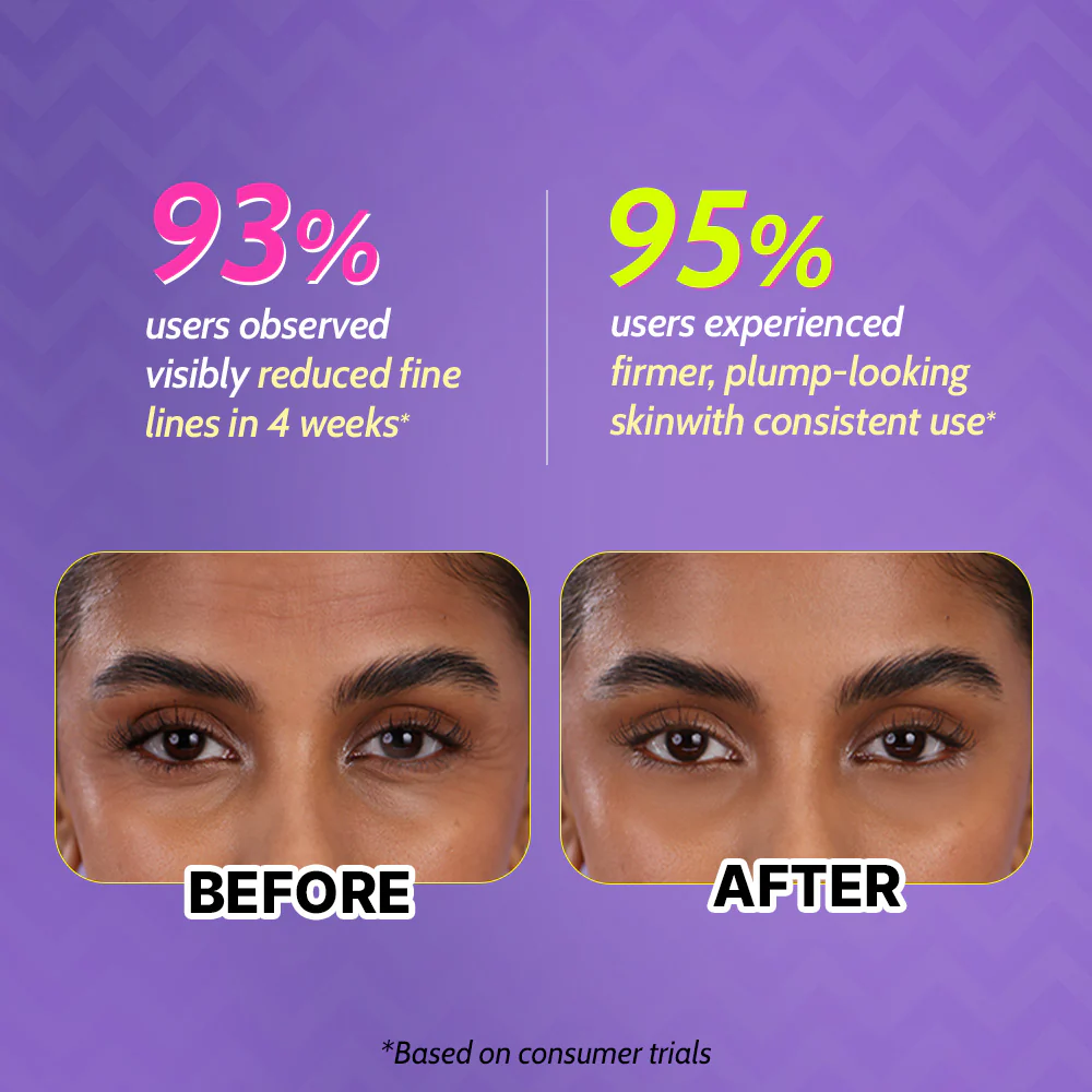 0.1% Retinol Night Cream for Fine Lines & Wrinkles - 30 gm - Image 4