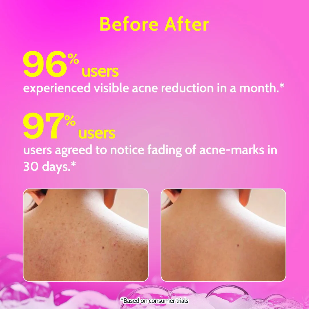 1% Salicylic Acid Body Wash for Acne Control - 236 ml - Image 5