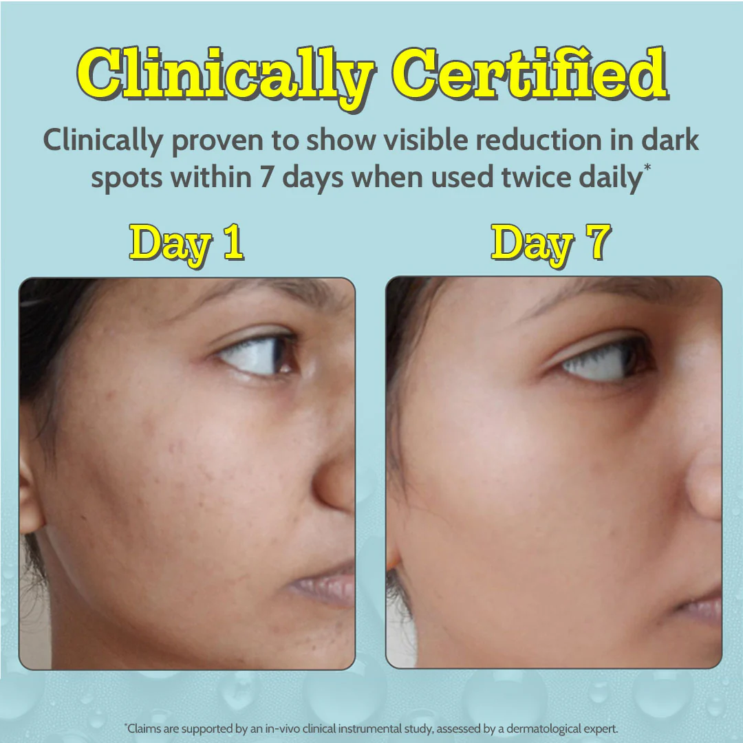10% Vitamin C Serum for Glowing & Bright Skin - 30 ml - Image 3