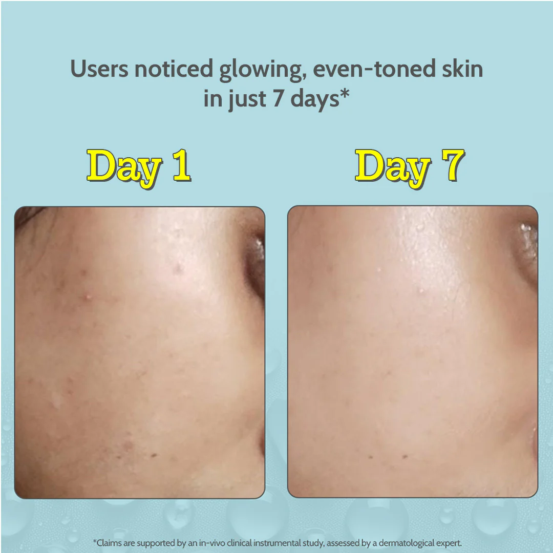 10% Vitamin C Serum for Glowing & Bright Skin - 30 ml - Image 4