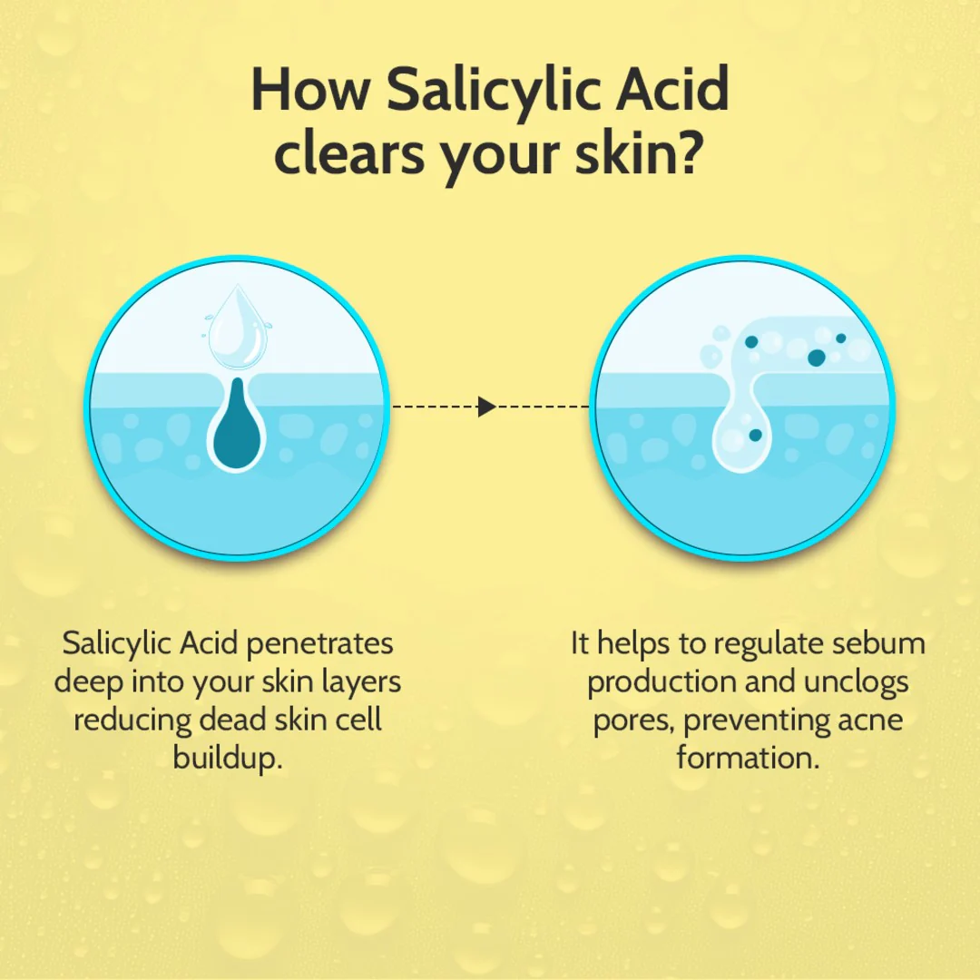 2% Salicylic Acid Face Serum for Acne Control - 10 ml - Image 6