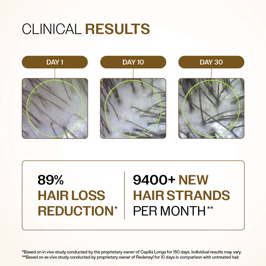 Advanced Hair Growth Serum with 3% Redensyl, 4% Anagain, 3% Bicapil & 1% Capilia Longa - 30 ml - Image 3
