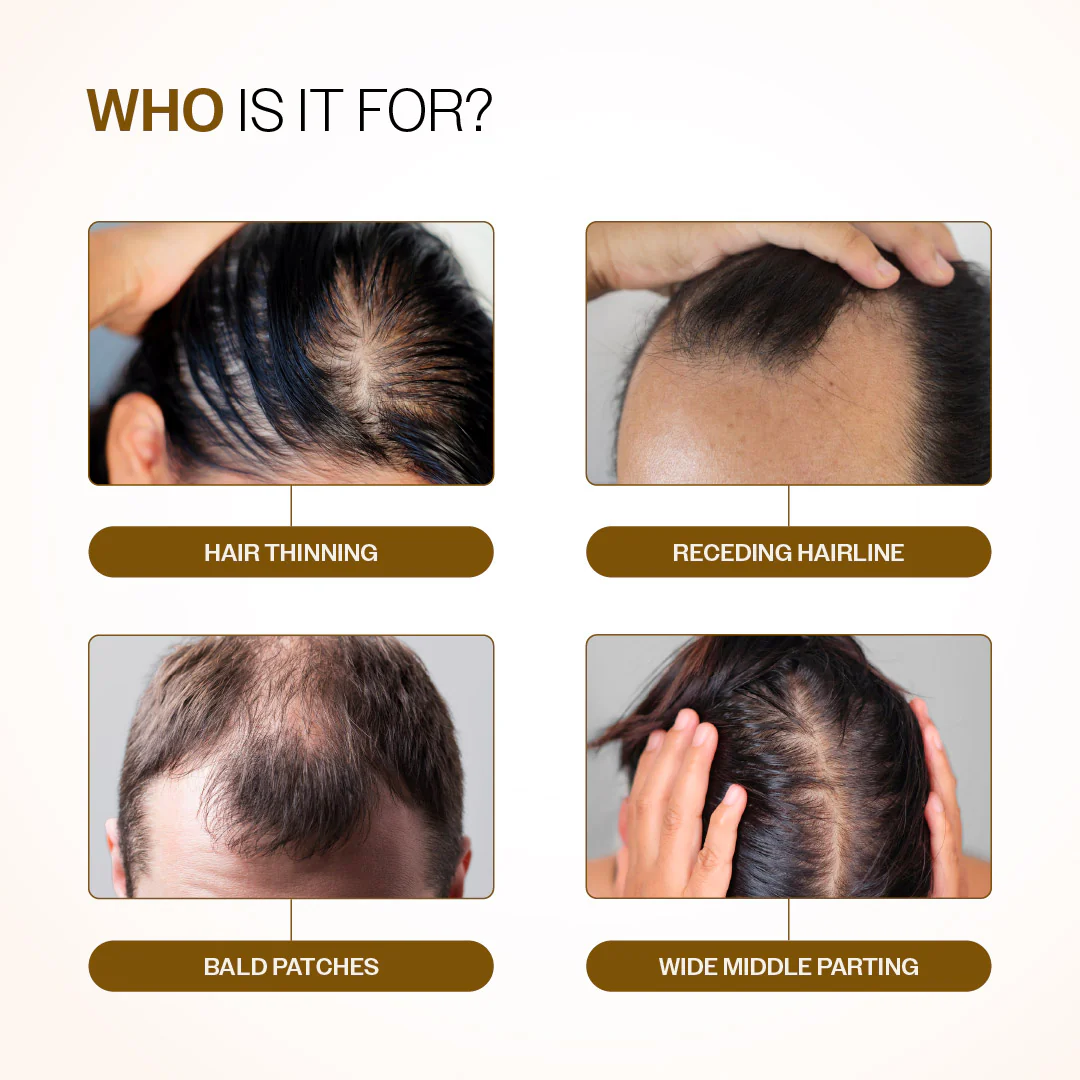 Advanced Hair Growth Serum Roll-On with Redensyl, Rosemary & Rice Water- 25 ml - Image 3