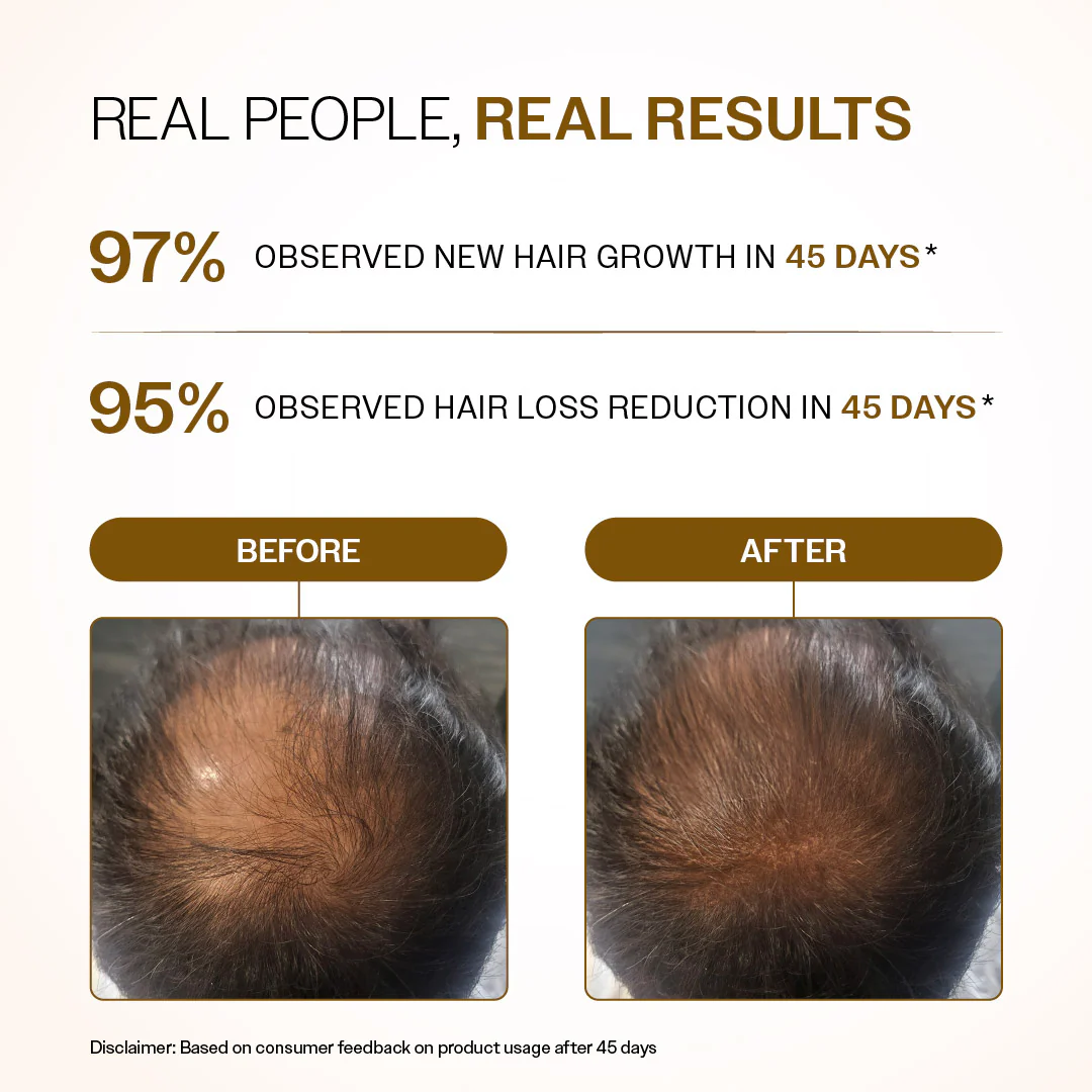 Advanced Hair Growth Serum Roll-On with Redensyl, Rosemary & Rice Water- 25 ml - Image 4