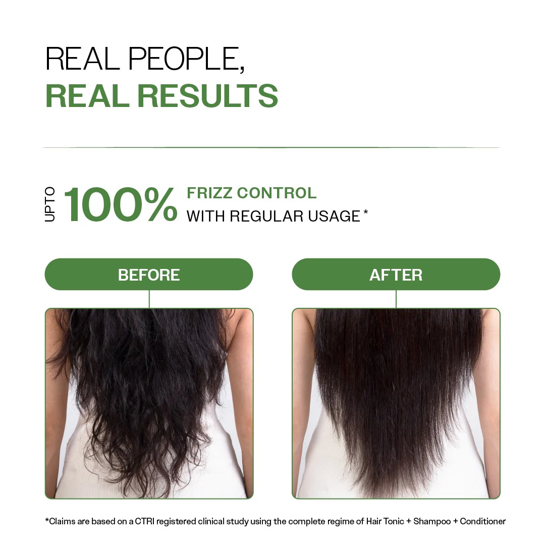 Anti-Dandruff Shampoo (250 ml) & Conditioner (175 gm) Combo with Salicylic Acid & Rosemary - Image 5