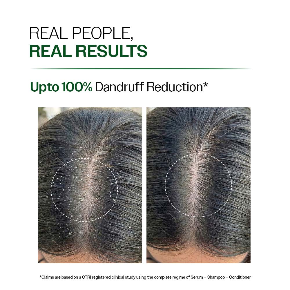 Anti Dandruff Shampoo with Salicylic Acid, Piroctone Olamine & Biotin - 750 ml | Pack of 2 - Image 3