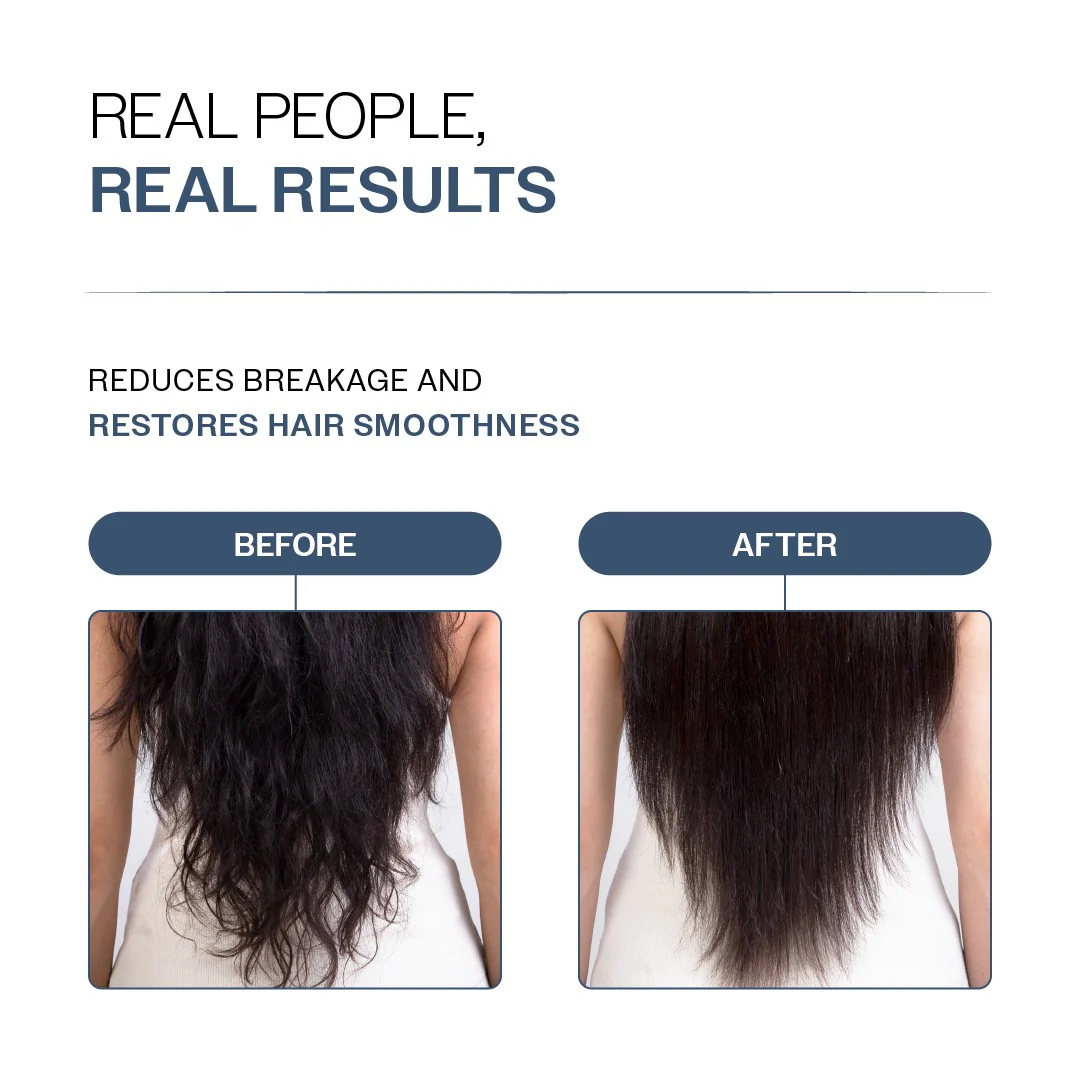 Anti-Hair Fall Shampoo (250 ml) & Conditioner (175 gm) Combo with Redensyl & Rosemary - Image 6