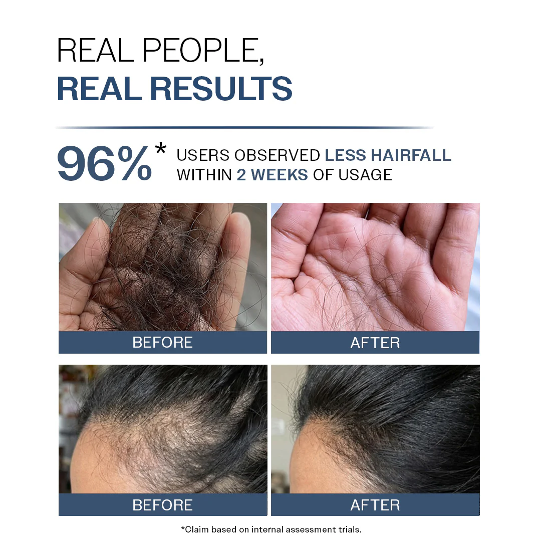 Anti-Hair Fall Shampoo with Adenosine & Peptides | 5X Hairfall Control - 250 ml - Image 4