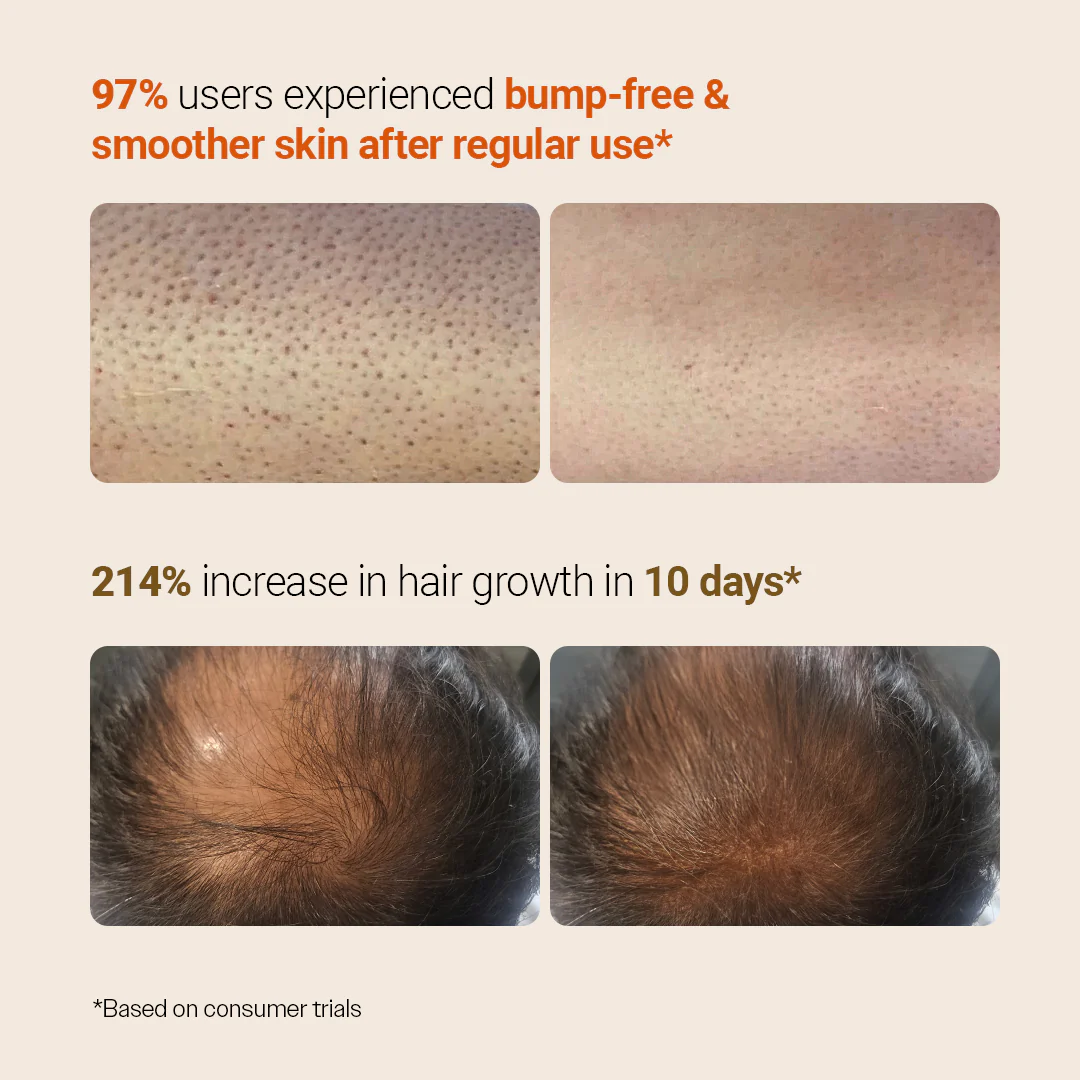 Every Day Body + Haircare Duo (Hair Growth Serum - 30 ml & Exfoliating Body Wash - 236 ml) - Image 6