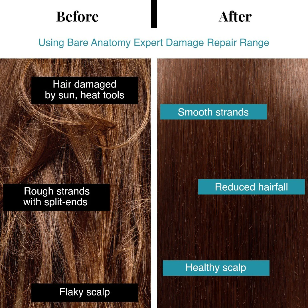 Damage Repair Kit (Shampoo - 250 ml | Mask - 250 gm) - Image 8
