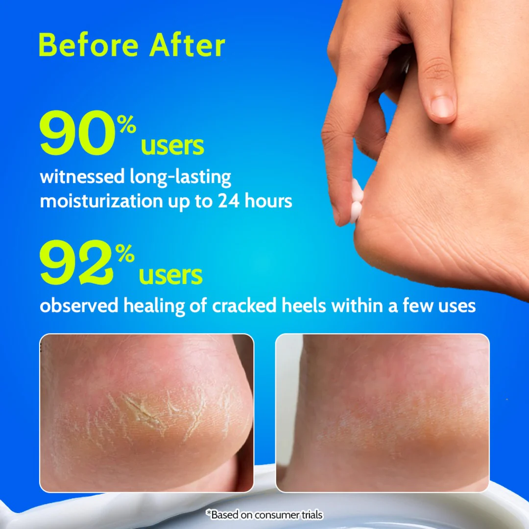 Foot Cream for Cracked Heels & Diabetic Foot - 50 gm - Image 3