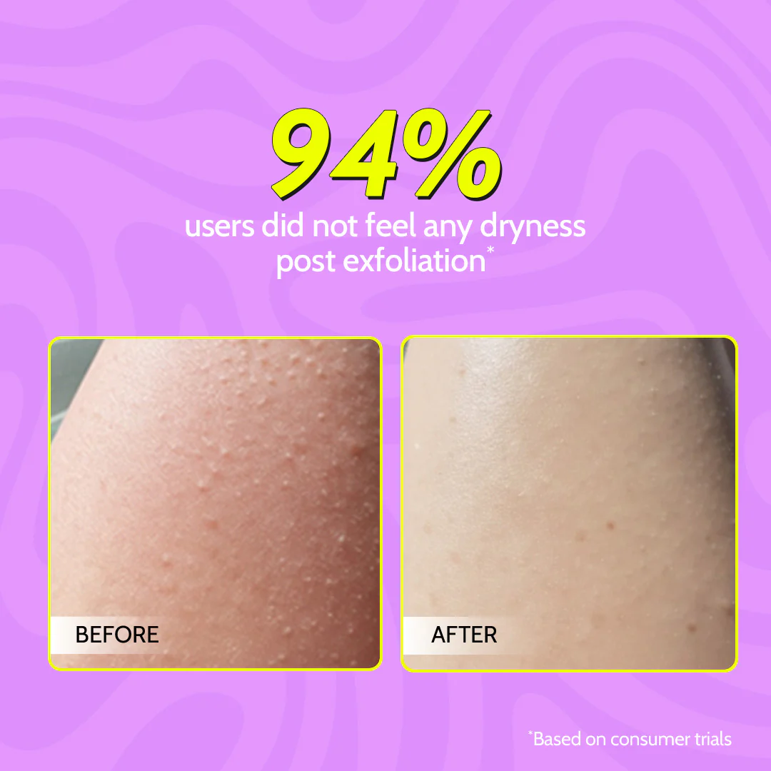 Complete Exfoliation Duo (Gentle Exfoliating Face Scrub - 100 ml | Exfoliating Body Scrub - 75 gm) - Image 6