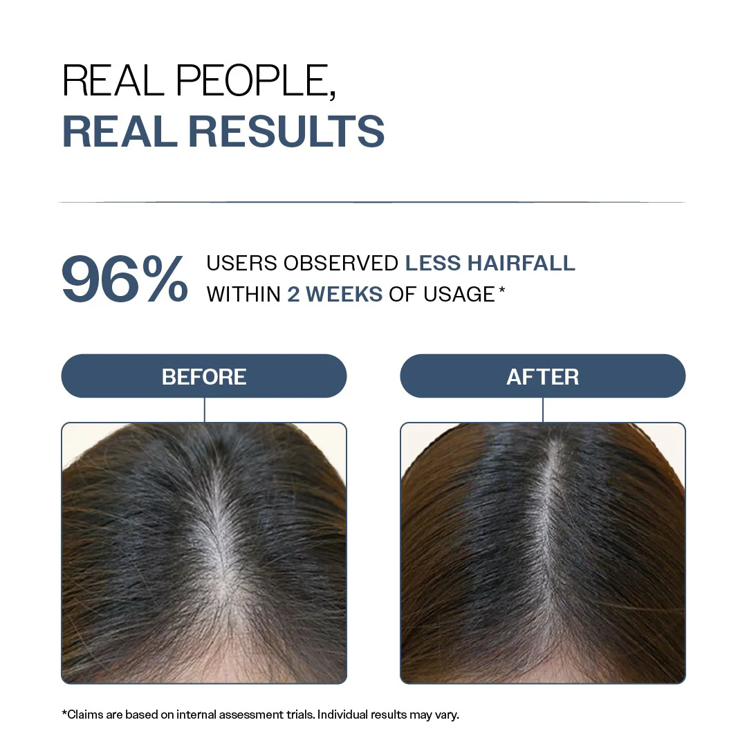 Anti-Hair Fall Shampoo with Adenosine & Peptides - 250 ml  | Pack of 2 - Image 5