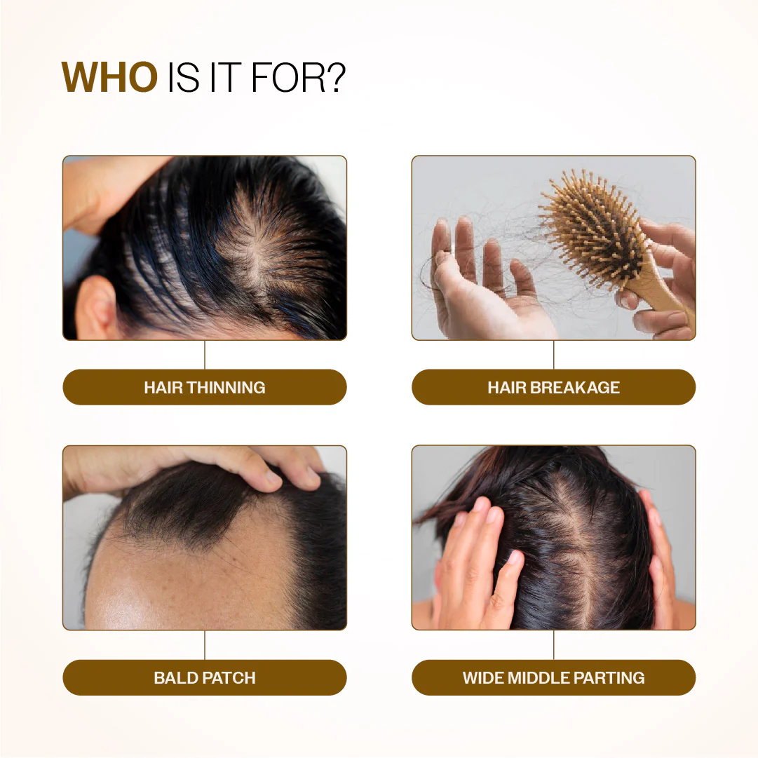 Hair Growth & Strength Combo (Hair Growth Serum Roll On - 25 ml | Anti-Hairfall Shampoo - 250 ml) - Image 7
