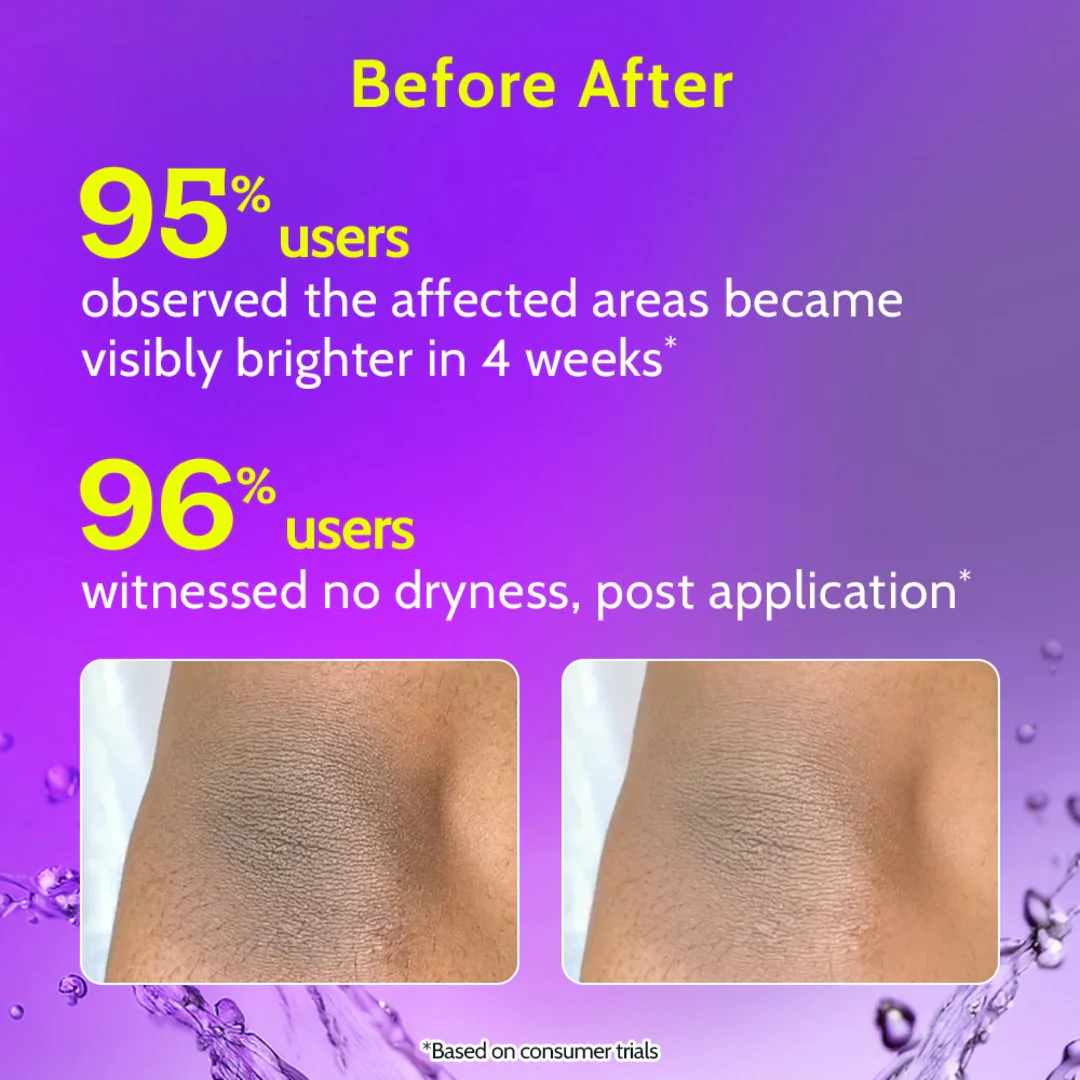 Neck, Knee & Elbow Brightening Roll On - 40 ml - Image 4