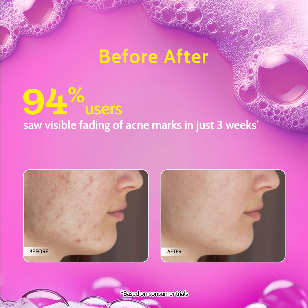 2% Salicylic Acid Face Wash for Acne & Oil Control - 100 ml | Pack of 2 - Image 5