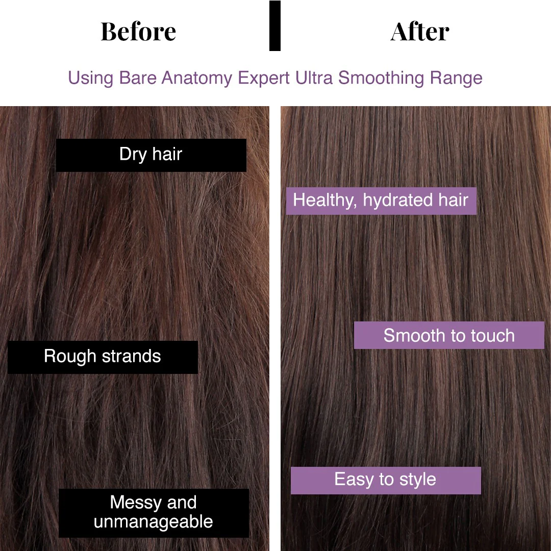 Ultra Smoothing Serum - 100 ml | Pack of 2 - Image 6