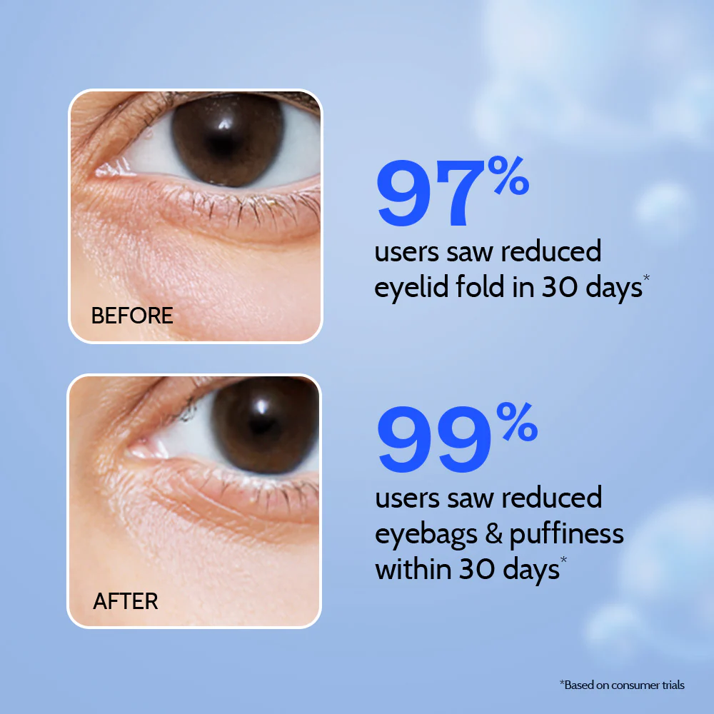 Under Eye Cream with Caffeine & Green Tea - 15 gm - Image 4