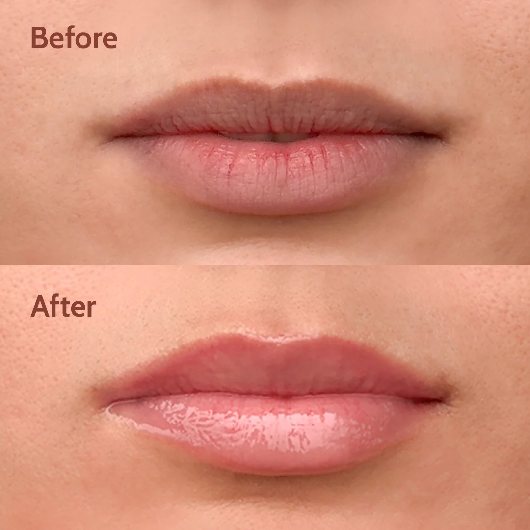 Ceramides + 2% Kojic Acid Lip Balm (Vanilla) | SPF 50 PA++++ | 10 gm - Image 5